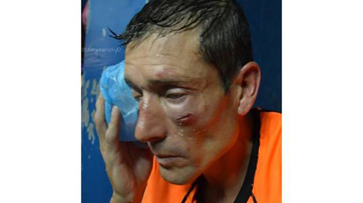 Violencia en el F&uacute;tbol