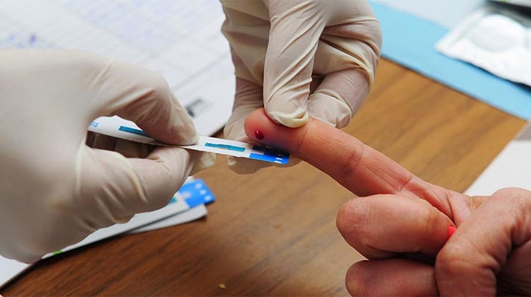 Testeo r&aacute;pido de HIV