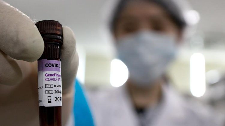 Preocupan​te: 7 casos m&aacute;s de coronavirus